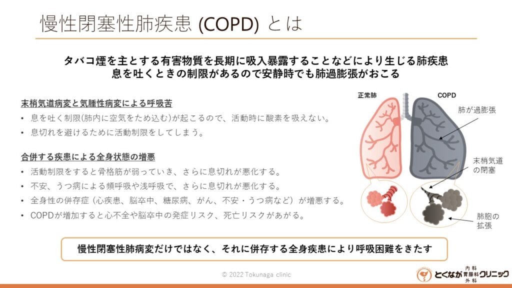 COPD のイメージ画像