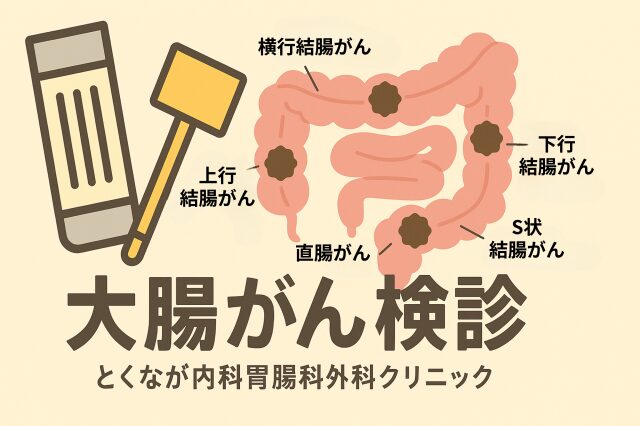 大腸がん検診 のイラスト