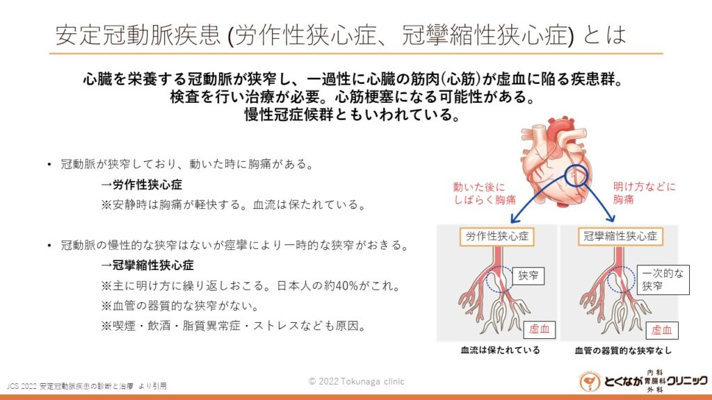 画像に alt 属性が指定されていません。ファイル名: %E3%81%A8%E3%81%8F%E3%81%AA%E3%81%8C%E3%82%AF%E3%83%AA%E3%83%8B%E3%83%83%E3%82%AF%E3%80%80%E5%AE%89%E5%AE%9A%E5%86%A0%E5%8B%95%E8%84%88%E7%96%BE%E6%82%A3-%E5%8A%B4%E4%BD%9C%E6%80%A7%E7%8B%AD%E5%BF%83%E7%97%87%E3%80%81%E5%86%A0%E6%94%A3%E7%B8%AE%E6%80%A7%E7%8B%AD%E5%BF%83%E7%97%87-%E3%82%B9%E3%83%A9%E3%82%A4%E3%83%89-1024x576.jpg