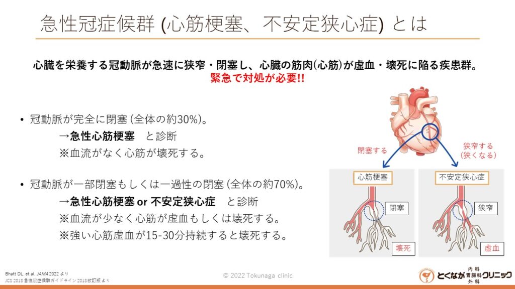 画像に alt 属性が指定されていません。ファイル名: %E3%81%A8%E3%81%8F%E3%81%AA%E3%81%8C%E3%82%AF%E3%83%AA%E3%83%8B%E3%83%83%E3%82%AF%E3%80%80%E6%80%A5%E6%80%A7%E5%86%A0%E7%97%87%E5%80%99%E7%BE%A4-%E5%BF%83%E7%AD%8B%E6%A2%97%E5%A1%9E%E3%80%81%E4%B8%8D%E5%AE%89%E5%AE%9A%E7%8B%AD%E5%BF%83%E7%97%87-%E3%82%B9%E3%83%A9%E3%82%A4%E3%83%89-1024x576.jpg