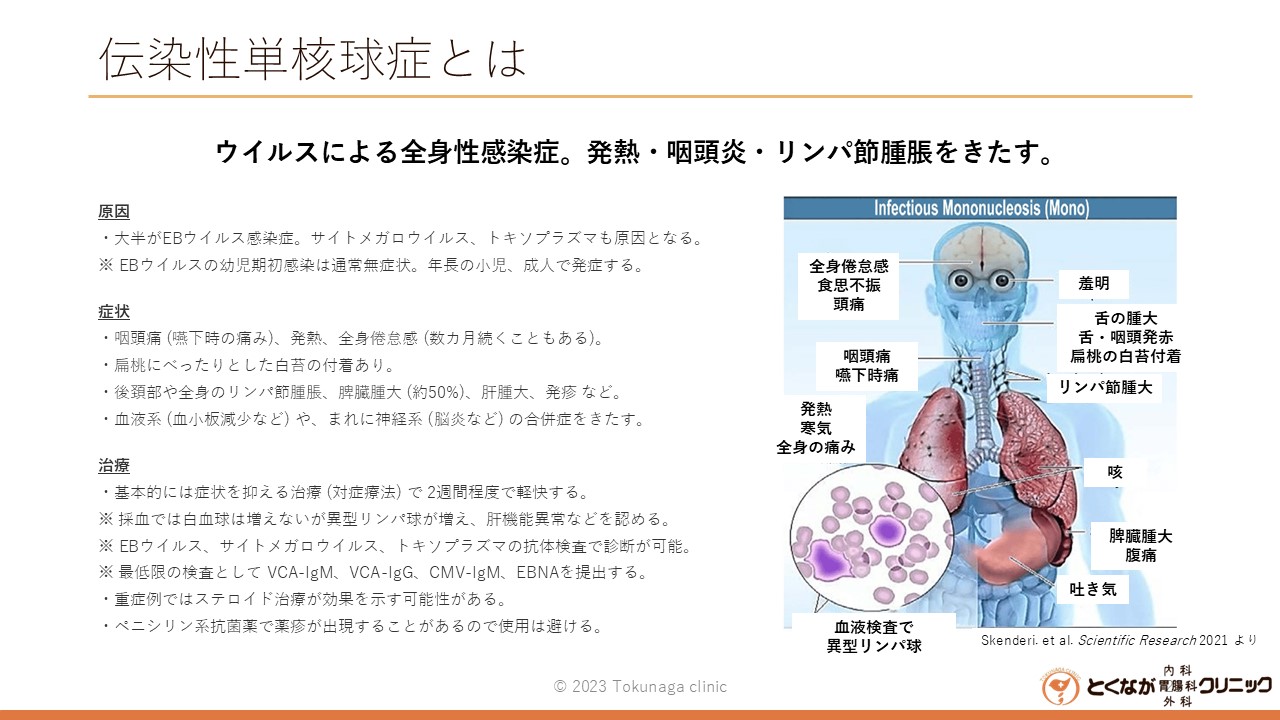 伝染性単核球症 とは? - とくなが内科胃腸科外科クリニック | 熊本市 東区 胃カメラ 大腸カメラ かかりつけ医