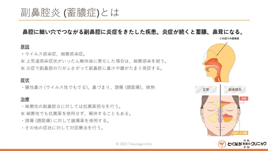 副鼻腔炎 のイメージ画像