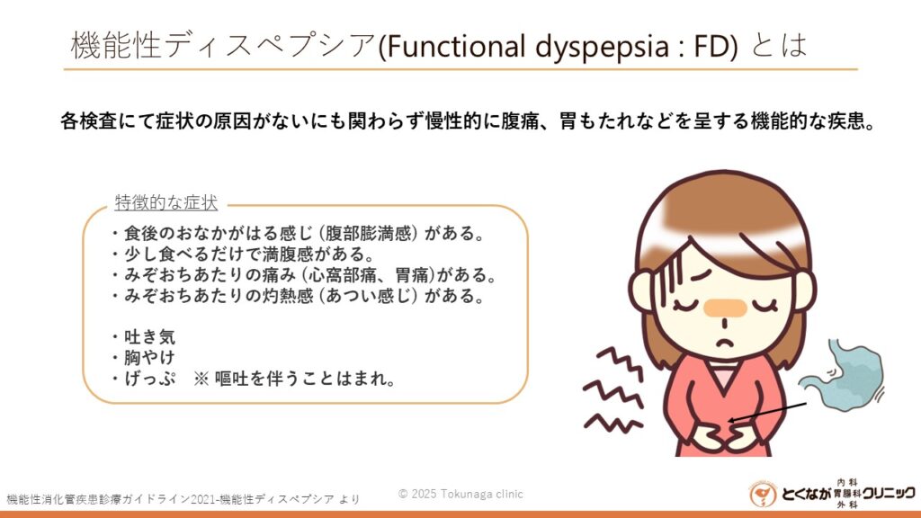 機能性ディスペプシア　のイメージ画像