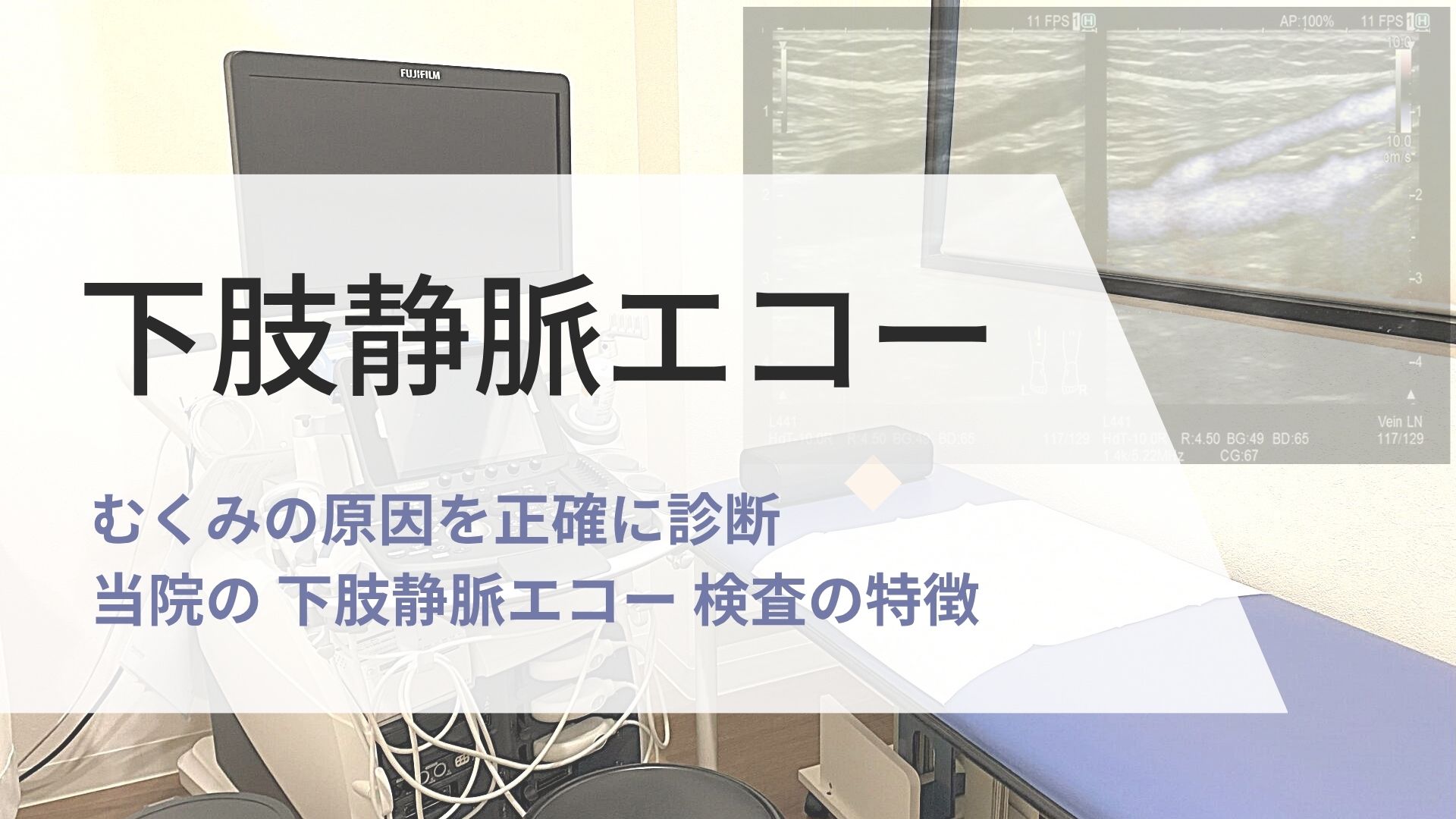 当院の 下肢静脈エコー 検査の特徴 - とくなが内科胃腸科外科