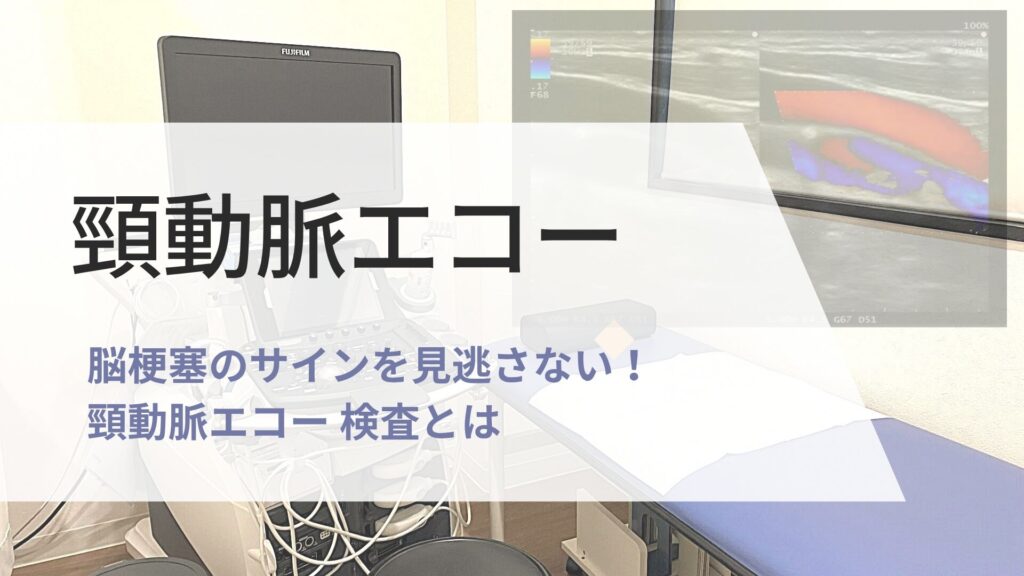 頸動脈エコー 検査の画像